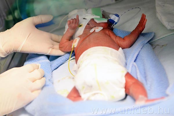 Vizsgálják, miként alakulnak ki a gyermekeknél az érbetegségek