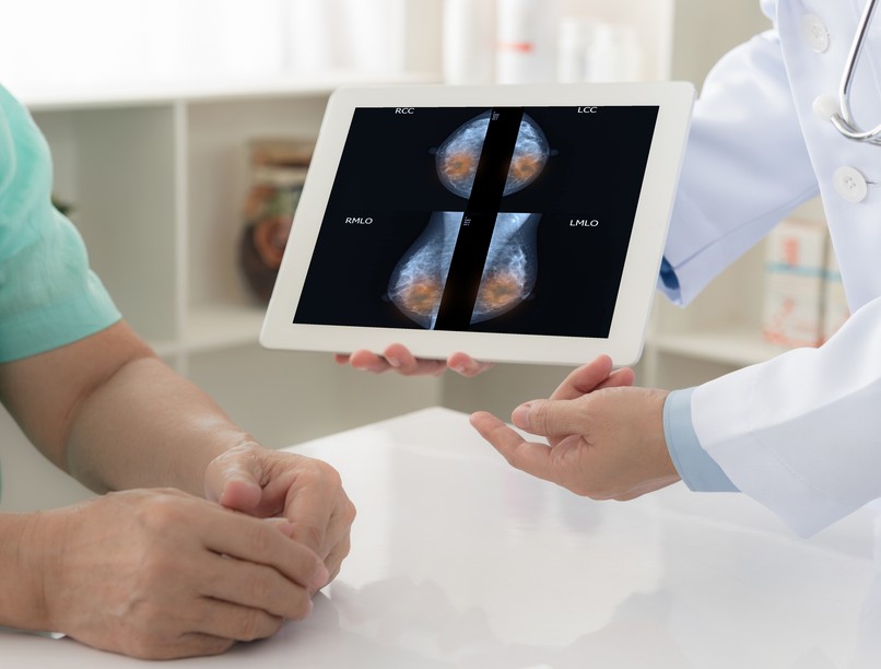 mellrák mellrákszűrés emlőrák szűrővizsgálat