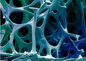 Orvosi siker: új módszer a csontritkulás mérésére!