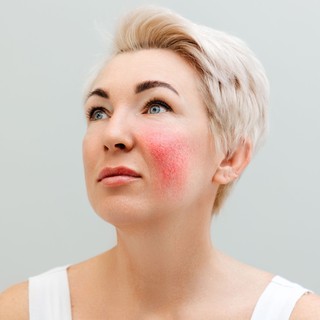 Mire utal a piros arc? című cikk nyitóképe