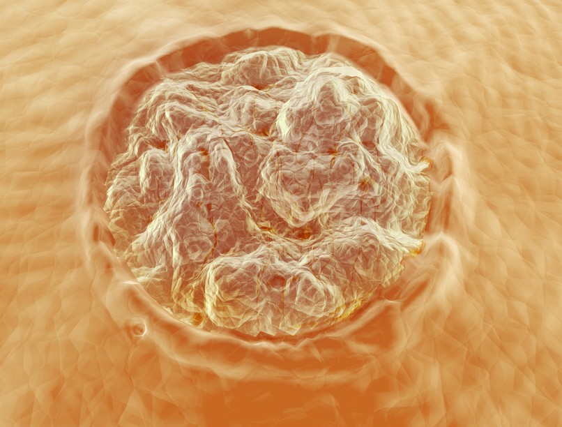 Nemi szervi szemölcs, tünetei, kezelése, HPV, vírus, humán papilloma vírus