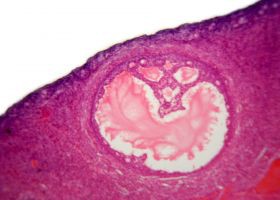 Vérzési rendellenességek