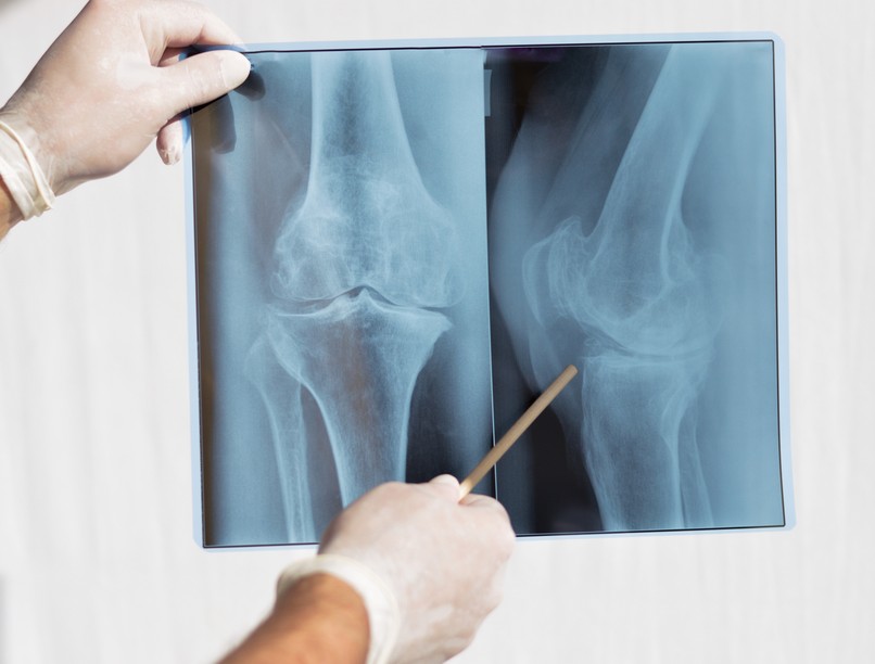 hírek röntgenkészülék pécsi belgyógyászat klinika