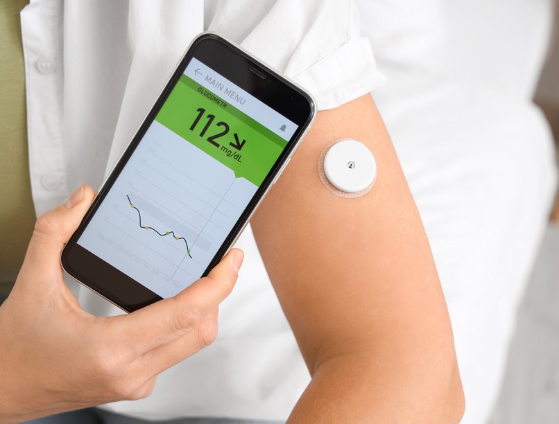 cukorbetegség cgm szöveti cukor monitorozás