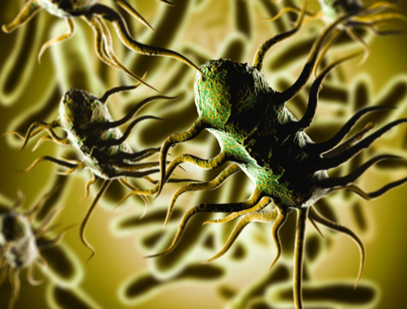 Liszteriózis, fertőzés, oka, tünete, lefolyása, kezelése, lisztéria-fertőzés, ételmérgezés, hasmenés