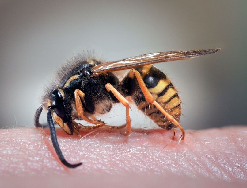 darázscsípés allergia tünetei mennyi idő