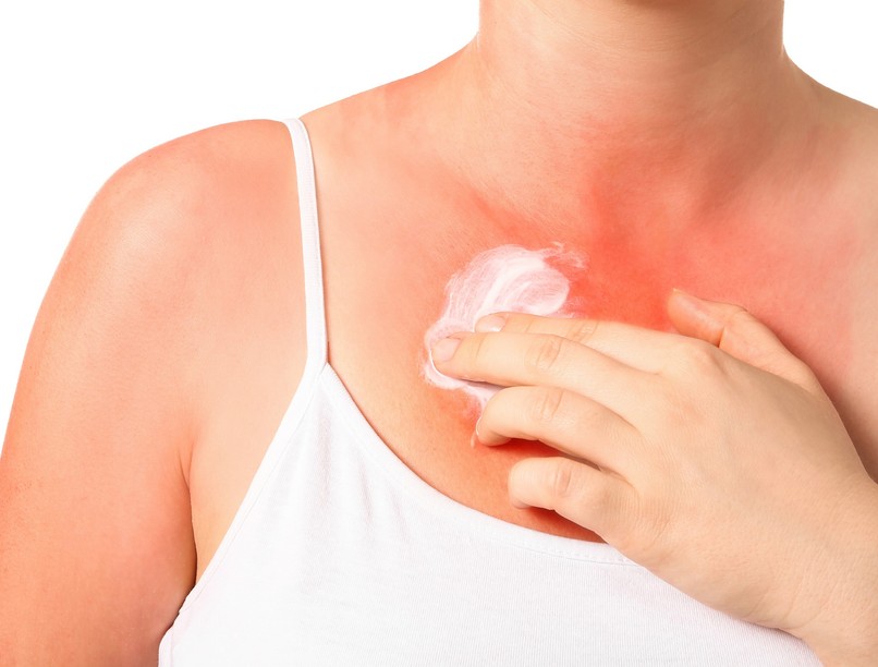 napallergia kezelése házilag