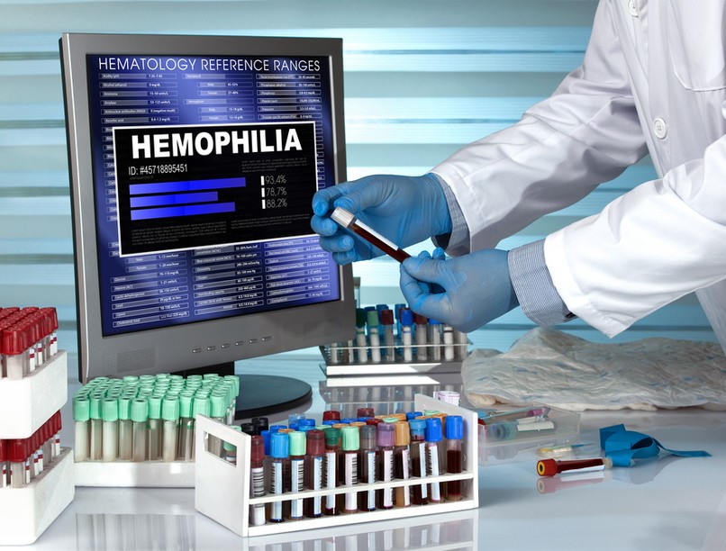 hemofília, vérzékenység, véralvadási rendellenesség, von Willebrand betegség, örökölt vérzési rendellenesség, plazmadonor, vérplazma, Hemofília Világnapja