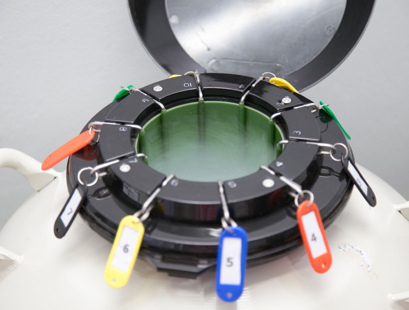 új eljárás daganatos gyerekek későbbi gyermekvállalása Semmelweis