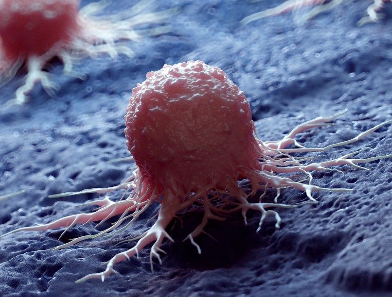 tumor, daganat, oka, tünete, áttét, rák jele