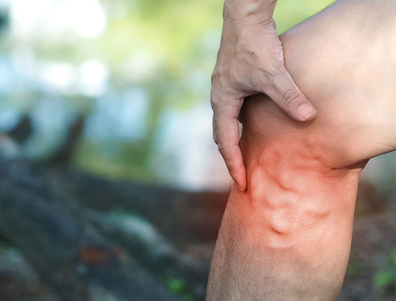 Visszértágulat tünet vizsgálat kezelés