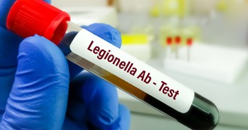 Légiós betegség: tünetei, vizsgálata és kezelési lehetőségei