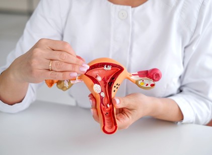 Mióma: jóindulatú daganat, amely néha nagyon is rosszindulatúan viselkedik című cikk nyitóképe