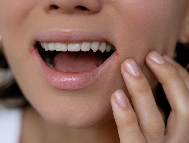 herpeszvírus nagyon gyors herpesz eltüntetés