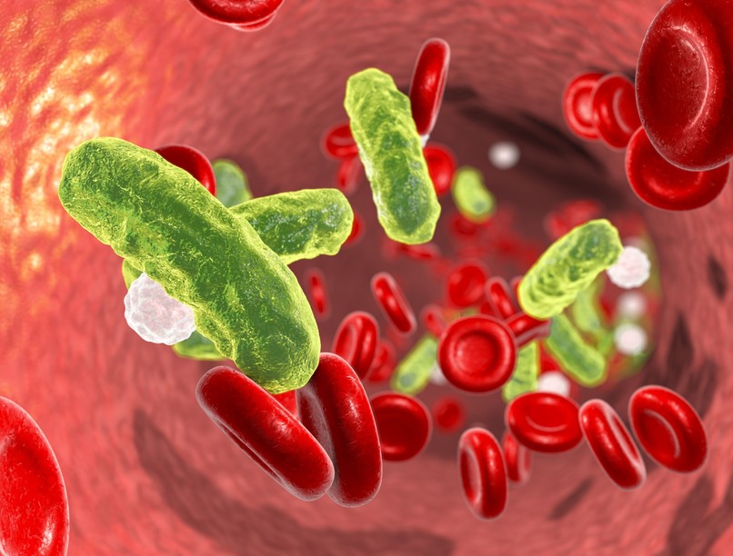 szepszis szülő gyilkos diagnosztizálás emberi történet