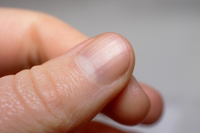 Mi a szerepe a kis fehér boltívnek a körmünkön?
