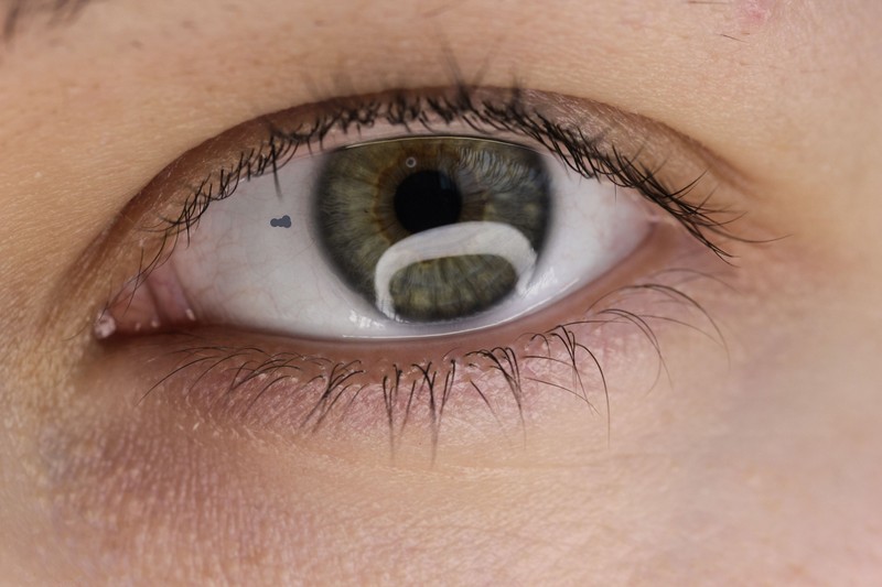 Apró, úszó foltokat, pöttyöket lát úszkálni a szemében, ami nincs is ott? Ez okozza