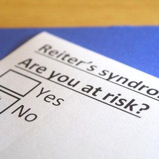 Reiter szindróma tünetei, vizsgálata és kezelése című cikk nyitóképe