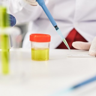 Hogyan lehet befolyásolni a vizelet fajsúlyát? című cikk nyitóképe