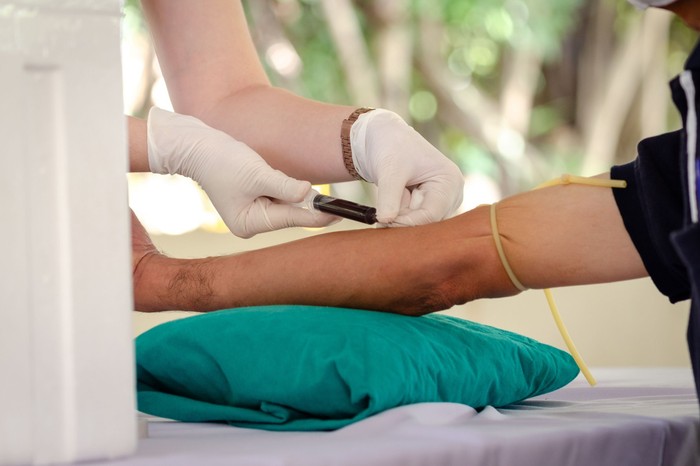 Vérvételre készül? Ezeket a hibákat sokan elkövetik