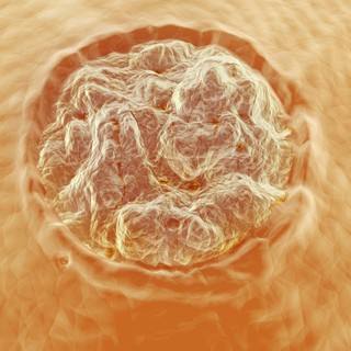 Nemi szervi szemölcs: tünetei vizsgálata és kezelési lehetőségei című cikk nyitóképe