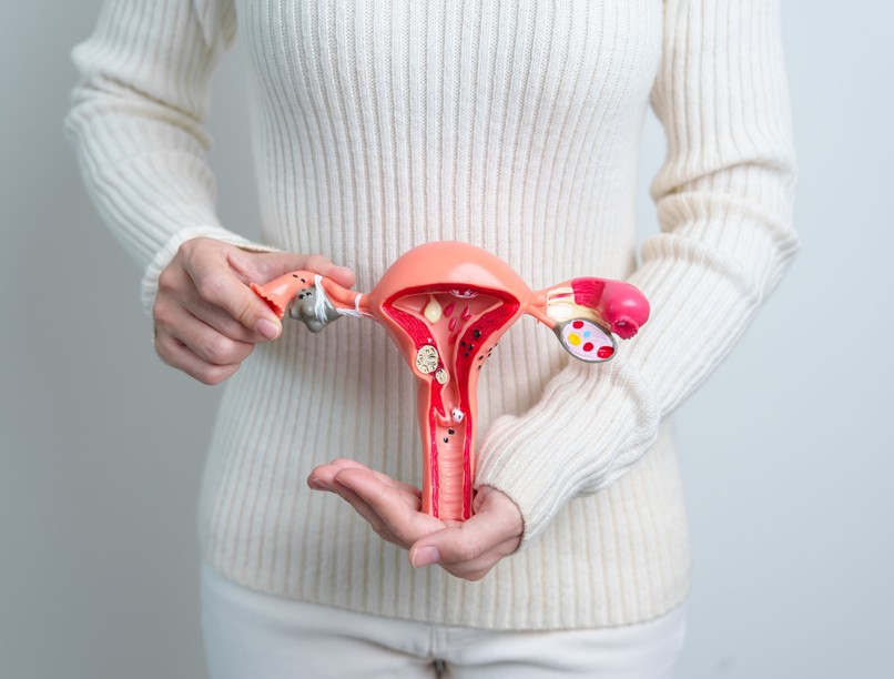 petefészekrák, szűrés, mikor, kockázat, nőgyógyász vizsgálat