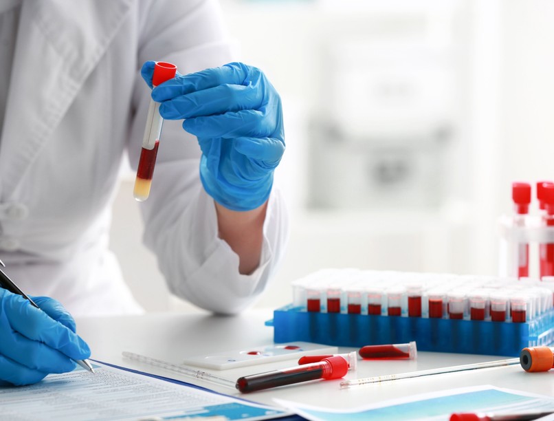 szűrővizsgálat ingyenes diagnózis tüdőszűrés