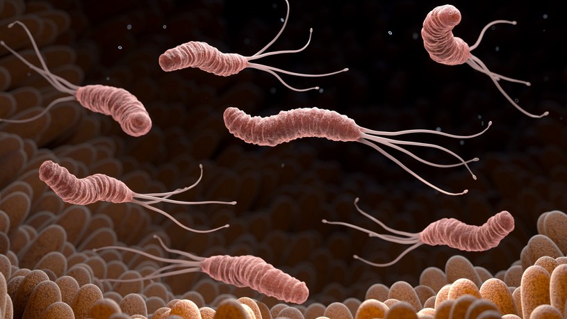 Helicobacter pylori baktérium fertőzés fekély gyomor rák fekély sok sav