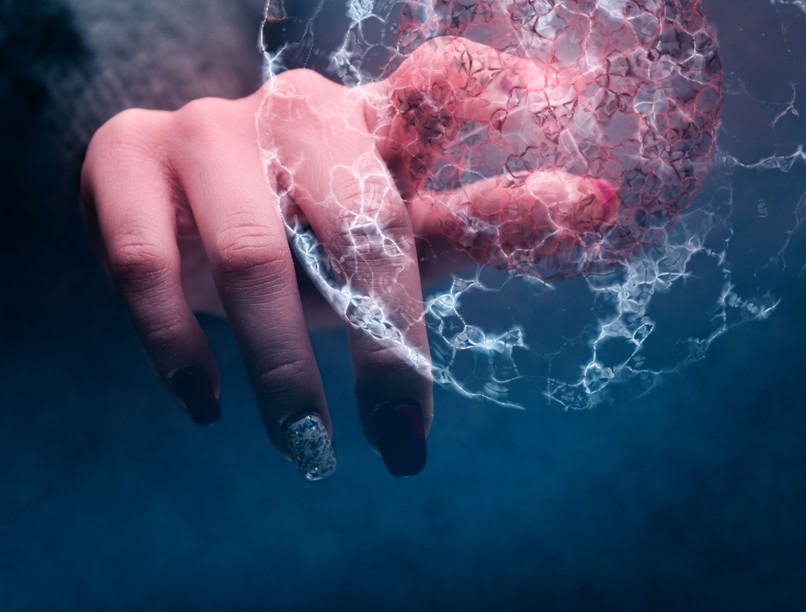 mielóma multiplex rák legyőzése szakértők találkozó