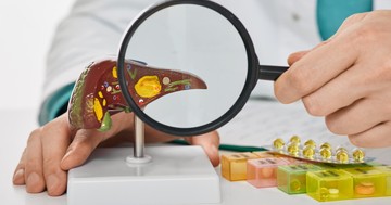  Májrák: legfontosabb jellemzői, tünetei, diagnosztikája és kezelési lehetőségei 