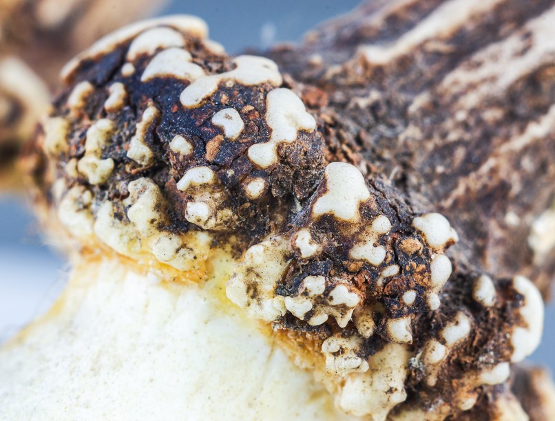 Oszteokondromatózis tünet vizsgálat kezelés