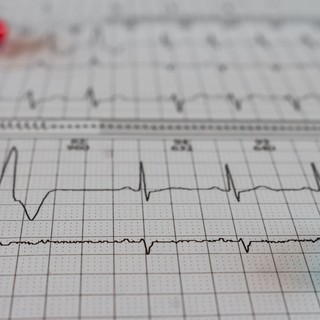 Szívbetegségek és stressz: 6 alattomos tünet, ami problémát jelezhet című cikk nyitóképe