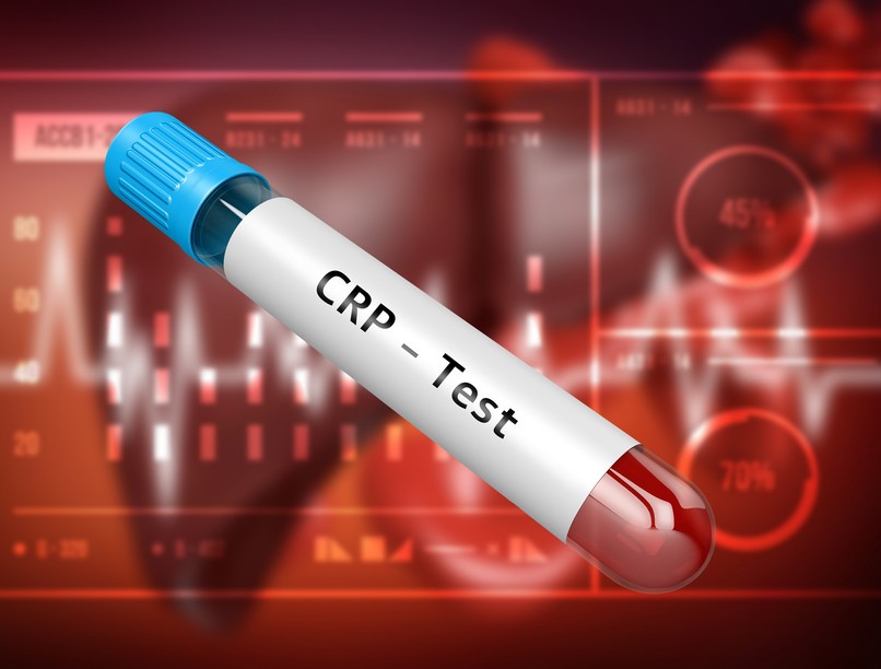 CRP, CRP-érték, gyulladás, fertőzés, krónikus betegség