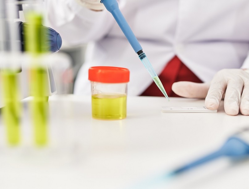 vizelet fajsúly hogyan lehet csökkenteni növelni