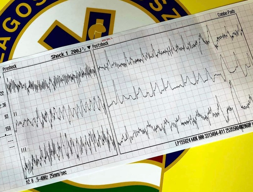 mentő, mentők, defibrillátor, sürgősségi