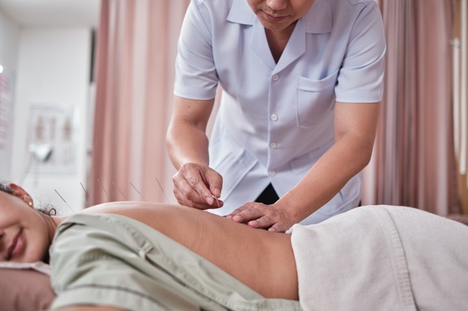 Az akupunktúra titkai: hogyan gyógyít a test saját energiája és milyen állapotokra hatásos a módszer? című cikk nyitóképe