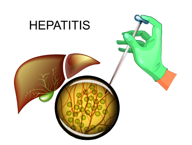 hepatitis_c_0