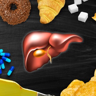 Kiderült, melyik ásványi anyag játszik kulcsszerepet a zsírmáj elleni küzdelemben című cikk nyitóképe