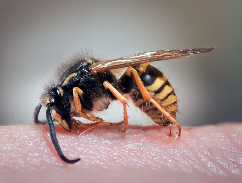 darázscsípés, után  orvos mikor