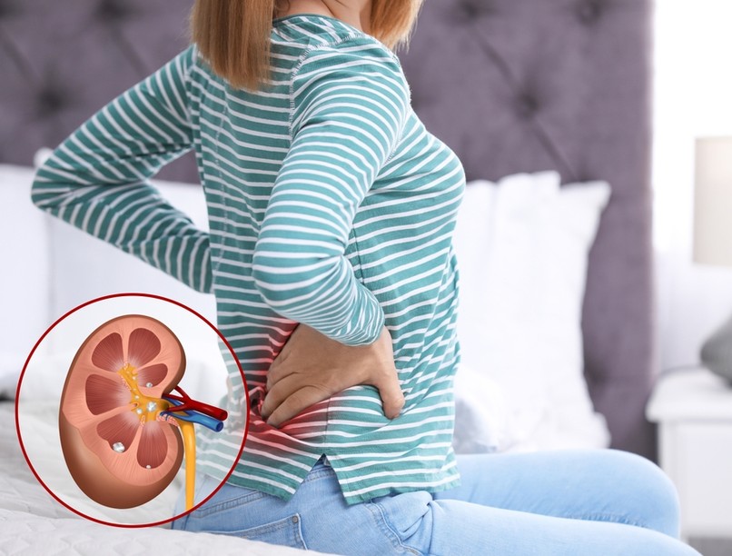 vesebetegség, CKD, idült vesebetegség, vesefunkció