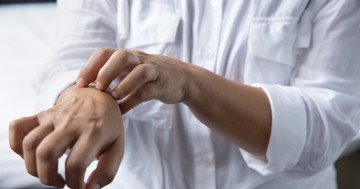 Húsvét után csalánkiütés és fejfájás? Hisztamin intolerancia is okozhatja!