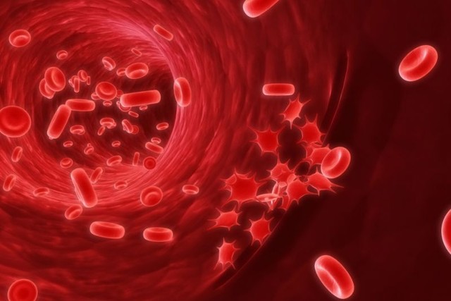 Irodai munka trombózis után