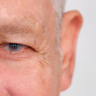 Mi a zöldhályog műtét? című cikk nyitóképe