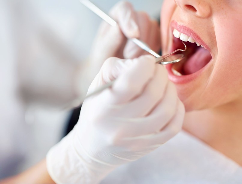 orvos válaszol fog tömés kiesik tejfog