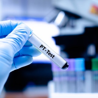 Mit jelent a protombin idő (PT) érték a laborleleten? című cikk nyitóképe