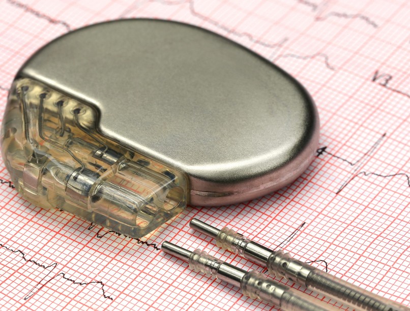 szívbetegség pacemaker, beültetés, után, orvos, tanács