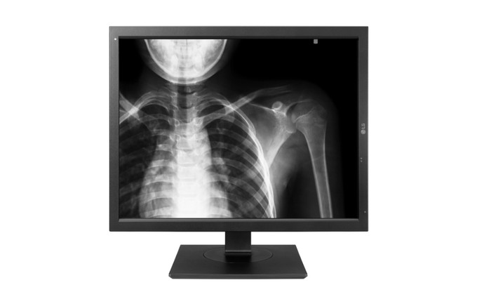 Hajszálpontos képet adhatnak az új kórházi monitorok című cikk nyitóképe