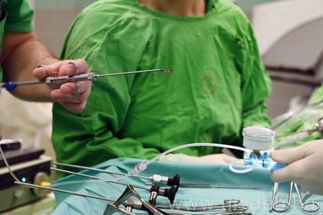 Biztosabb lélegeztetés műtét közben: új eljárást használnak ezen a klinikán