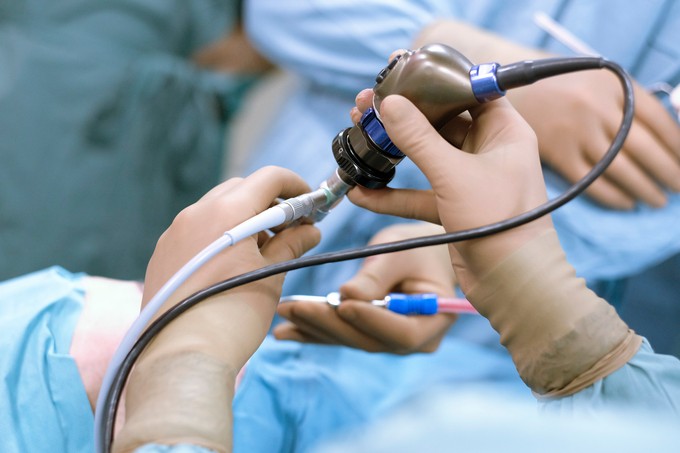 Mitől függ, hogy mennyire fáj a gyomortükrözés? című cikk nyitóképe