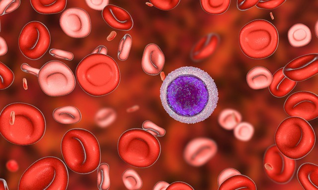 Leukémia: tünetei, kivizsgálása és kezelési lehetőségei